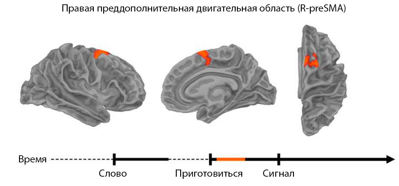 нейрофизиология заикания исследование