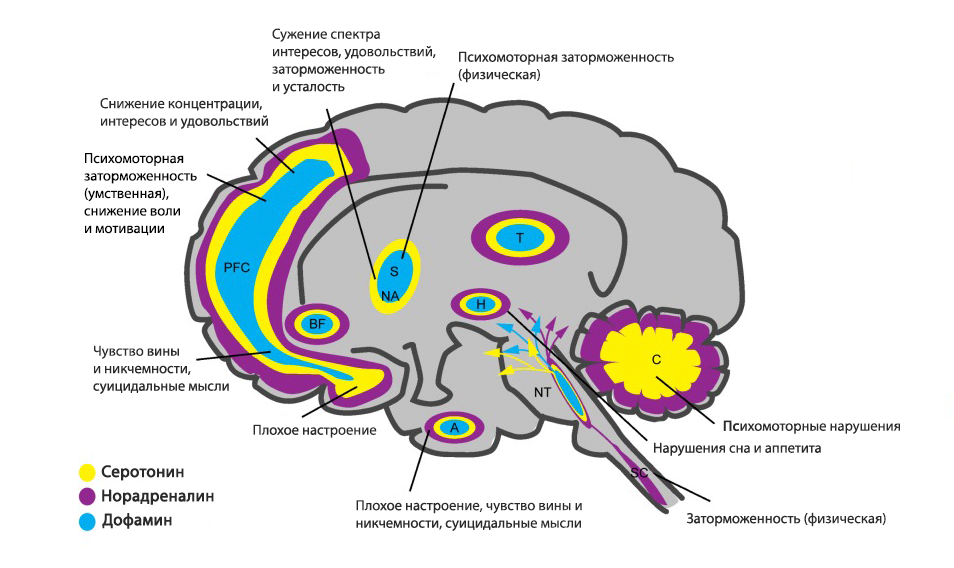Дефицит серотонина, дофамина и норадреналина в определенных областях мозга - депрессия