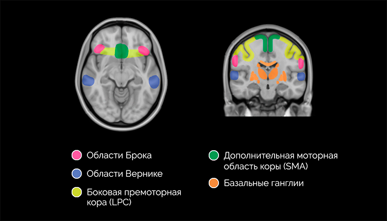 Карта речевых центров головного мозга